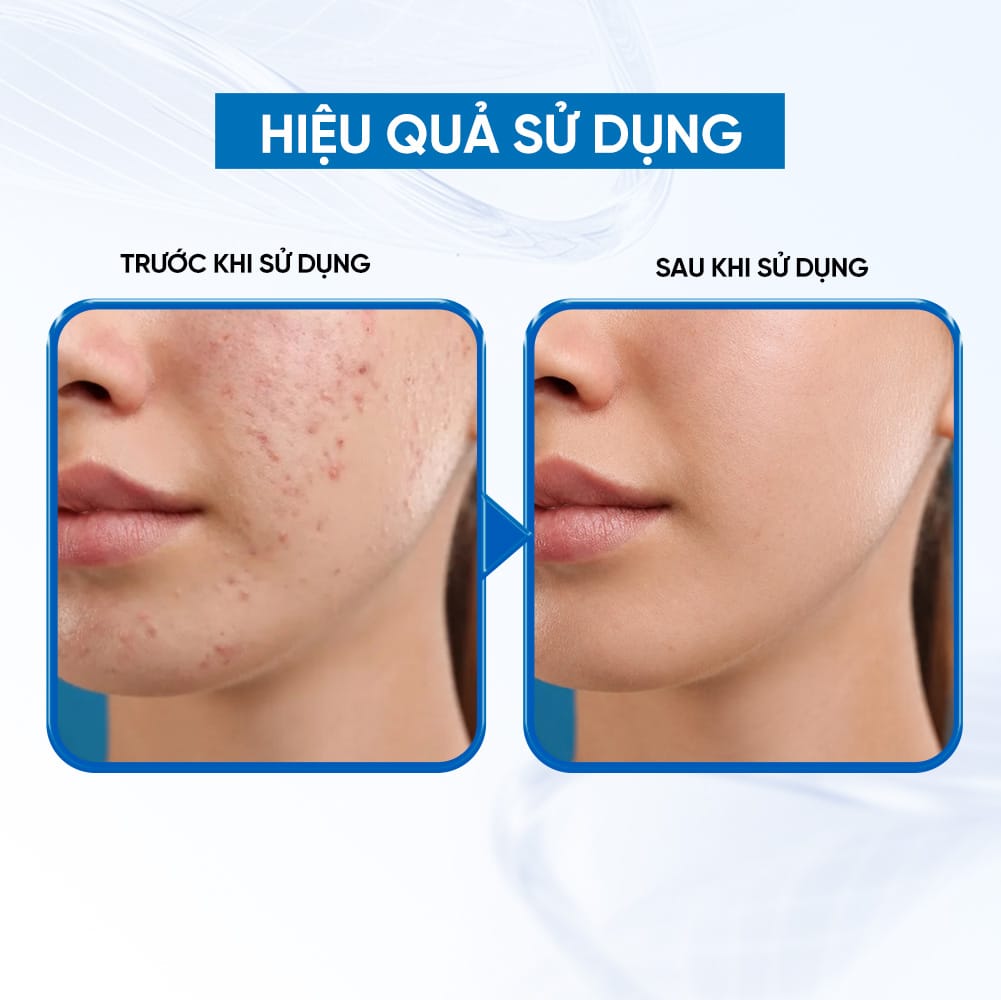 Bioessence Mask Cham - Mặt Nạ Hoa Cúc La Mã| Dưỡng Ẩm, Làm Dịu Da, Hỗ Trợ Phục Hồi Cho Da Nhạy Cảm | 10 Miếng x 30ML - Ảnh 4