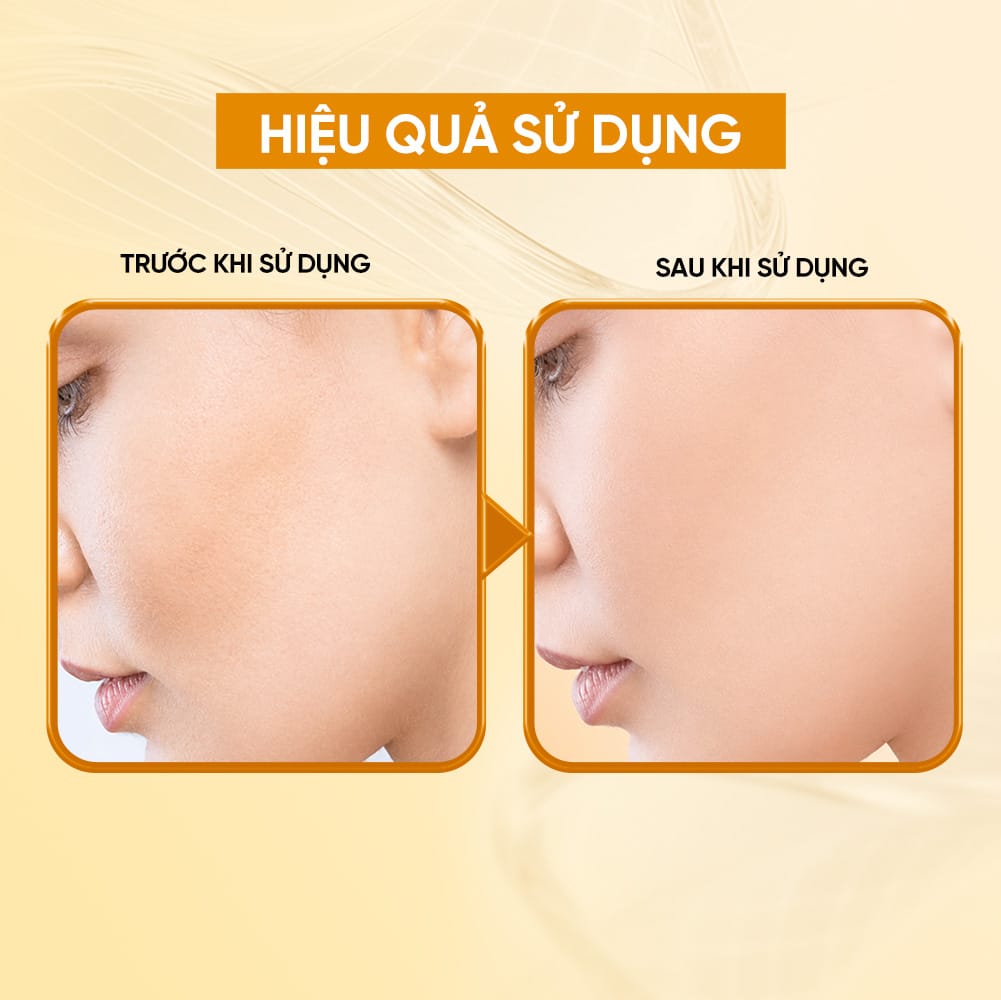 Bioessence Mask C - Mặt Nạ Vitamin C| Dưỡng Ẩm, Làm Dịu, Làm Sáng | 10 Miếng x 30ML - Ảnh 4