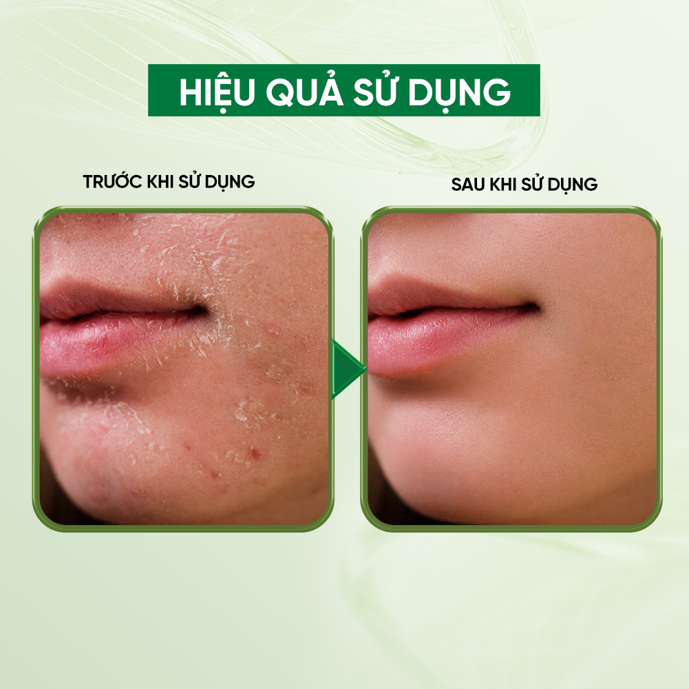 Bioessence Mask Pre - Mặt Nạ Sợi Xơ Rau Má Premium| Dưỡng Ẩm, Làm Mềm Da, Làm Dịu Da | 10 Miếng x 30ML - Ảnh 4