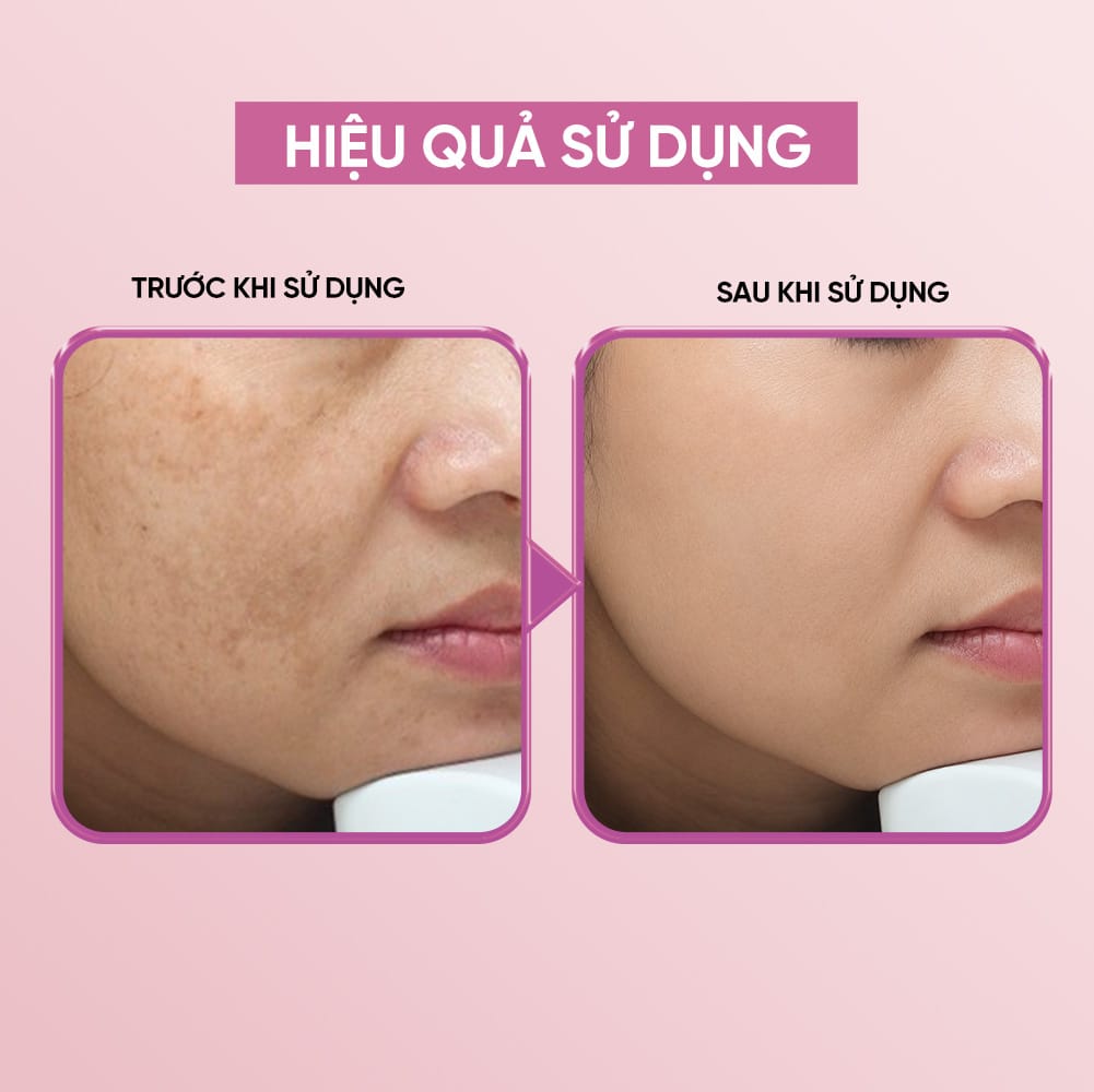 Biossence Mask O - Mặt Nạ Hành Tím| Dưỡng Ẩm, Làm Dịu, Mờ Thâm Sẹo| 10 Miếng x 30ML - Ảnh 4