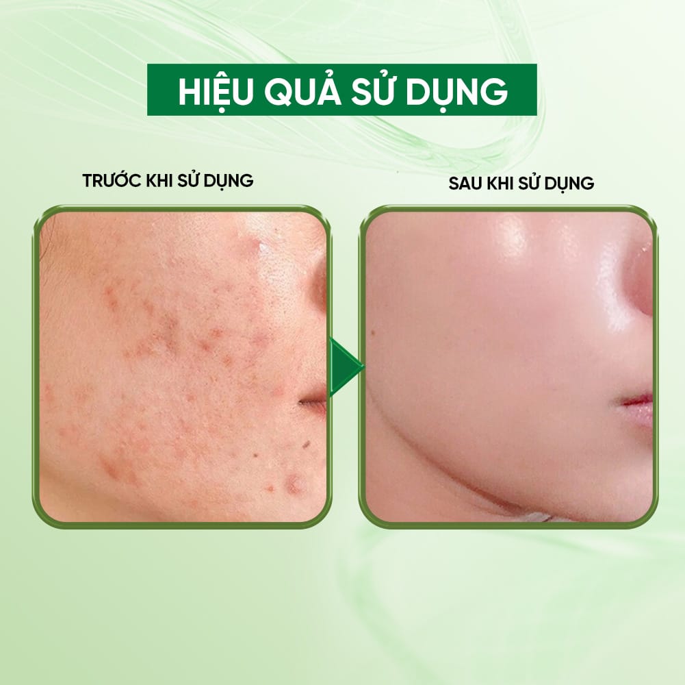 Cicamax Refine Serum - Serum Rau Má| Hỗ Trợ Làm Dịu Da, Ngừa Lão Hóa - Ảnh 3