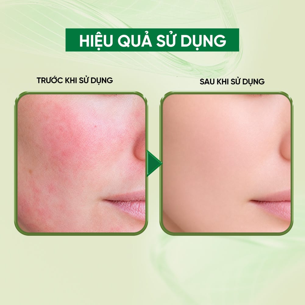 Bioessence Mask - Mặt Nạ Sợi Xơ Rau Má| Dưỡng Ẩm, Làm Dịu | 10 miếng x 30ML - Ảnh 4